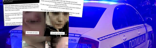 POTRESAN VAPAJ ZA POMOĆ! Drama u Surčinu: Devojka sa licem u masnicama, izbodena po nogama - nasilnik urlao, pretio i lupao sve pred sobom