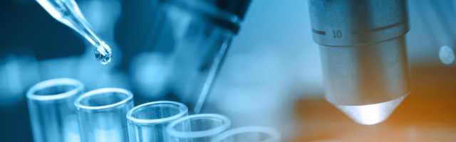 Koliko će koštati test na antitela?