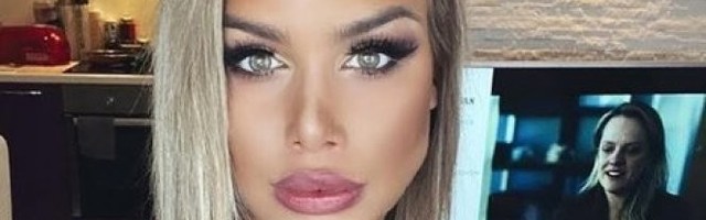 Ivana Nikolić PRIZNALA koliko puta je posetila PLASTIČNOG HIRURGA. Evo kako je IZGLEDALA NEKADA! /FOTO/