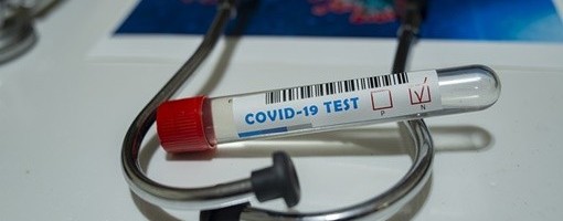 U BIH 1.186 novih slučajeva koronavirusa, umrle 52 osobe
