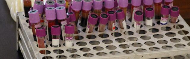 Nova analiza krvi mogla bi da otkrije rizik od najčešćeg srčanog oboljenja