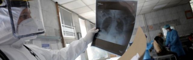 SVET U BORBI SA KORONOM! Zaraženo više od 8,7 miliona ljudi, u Brazilu više od milion obolelih, gotovo 50.000 umrilh!