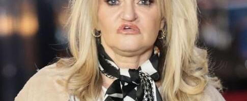 Glumica ponovo operisala lice nakon što se unakazila zavisnošču od droge: Kamere je snimile u Dubaiju