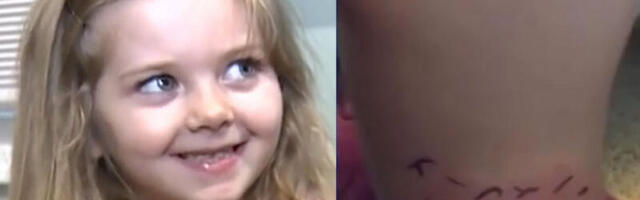 PRIMETILA JE OGROMNU MODRICU NA TELU SVOJE ĆERKE: Nije ni slutila u kakvoj je dete opasnosti, a onda je dobila JEZIVE vesti!