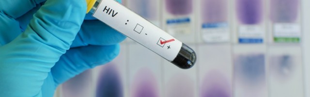 Danas je Svetski dan borbe protiv side: Najmlađa inficirana osoba ima samo 19 godina