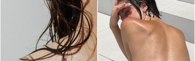 Kako da ublažite prekomerno znojenje – prema savetima dermatologa