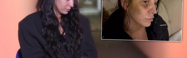ADNA JE BRUTALNO PRETUČENA JER JE NASILNIKU REKLA NE! Otišla da ga prijavi policiji, dočekao je hladan tuš: "Umij se da vidimo da li si našminkana!" (VIDEO)