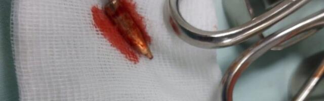 DEVOJKA RANJENA OD ZALUTALOG METKA NA SVADBI U PLJEVLJIMA: Držala sam bratanca u naručju i samo sam osetila toplinu, a zatim je krv krenula da lipti