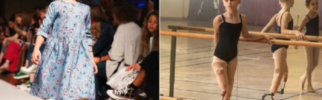 Devojčici amputirali noge: Nije je sprečilo da bude gimnastičarka i model