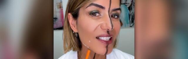 Doktorka sama sebi ubrizgala botoks u jednu stranu lica i pogledajte šta joj se dogodilo