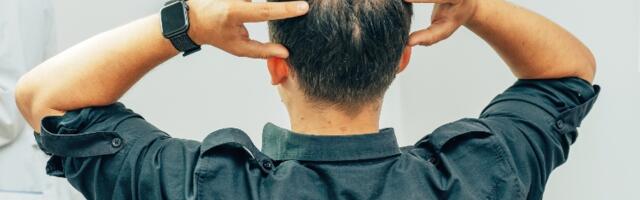 Naučnici otrili potencijalno rešenje za sprečavanje gubitka kose