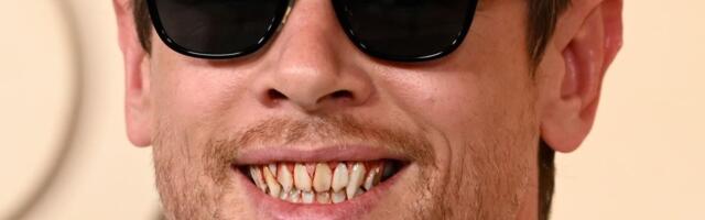 Odličan marketing: Glumac pokazao jezive zube na crvenom tepihu Oskara, sad svi pričaju o njemu!