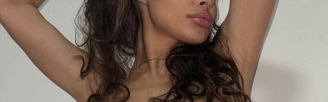 KAKO DANAS IZGLEDA NATAŠA ŠAVIJA? Batina joj UNAKAZILE lice, NAJNOVIJE SLIKE POSLE NIZA OPERACIJA