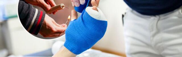 STRAVIČNO! Dečaku u Osijeku petarda eksplodirala u ruci: Amputirana mu dva prsta