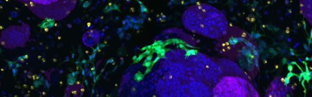 Budućnost je stigla, osmišljen naučnofantastični sistem: Kiborg tkivo obnavlja pankreas razoren dijabetesom