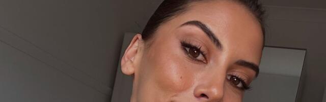 Imala 6 operacija, borila se za život nakon tretmana koji žene obožavaju: Mislila da će joj SRCE EKSPLODIRATI