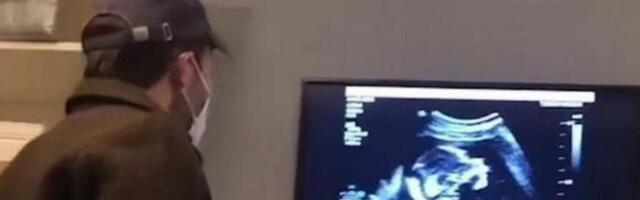 PONOSNI OTAC OTIŠAO SA DEVOJKOM NA ULTRAZVUK, A ONDA NIJE ZNAO ŠTA GA JE SNAŠLO: Nije mogao da VERUJE ŠTA VIDI