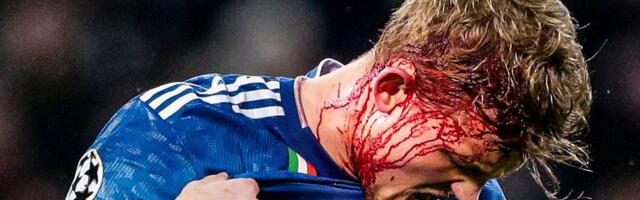 Fudbal nije za slabiće! /FOTO/