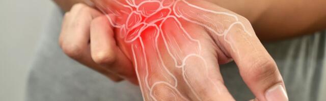 Tradicionalna brazilska biljka ima neočekivanu snagu protiv artritisa