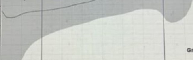 Tabela vakcina Džonson & Džonson izgleda kao veliki penis, i to veoma lep!