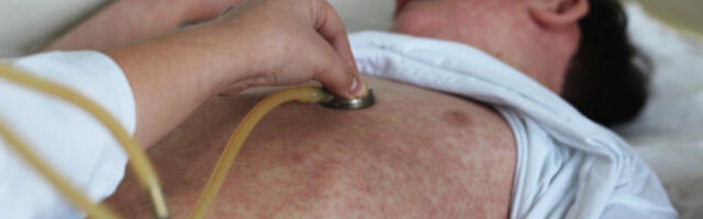 DEČAK ZARAZIO NA HILJADE LJUDI? Posetio bolestan Svetsku izložbu pre 15 dana, a sada je otkriveno da je bio POZITIVAN!