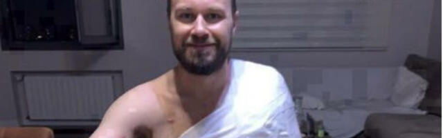 DA NEMA RADOJA ZVICERA RAT BI STAO! Preko Skaja komentarisali ranjavanje vođe u Ukrajini