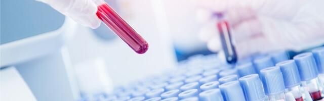 U Srbiji skoro 600 osoba boluje od hemofilije, neizlečive bolesti zgrušavanja krvi