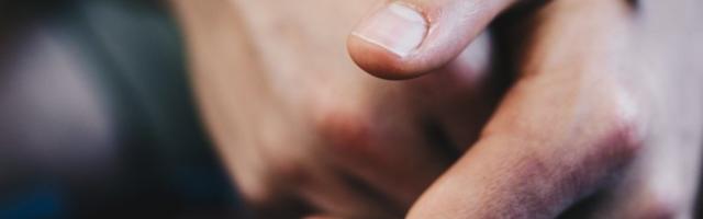 STALNO SU VAM HLADNE RUKE? Ne, niste dobri u krevetu - verovatno imate ozbiljan zdravstveni problem