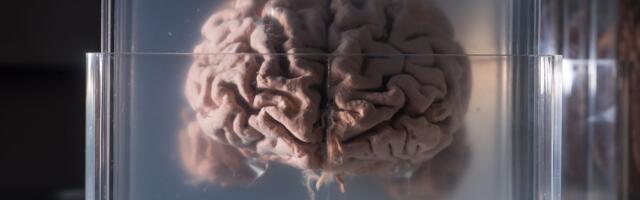 Naučnici otkrili šta se dešava s mozgom nakon smrti: "To je postepeni proces, može trajati satima"