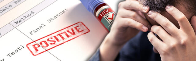 Više od 50% dijagnoza HIV-a postavlja se prekasno: Najgore je u 3 zemlje bivše SFRJ