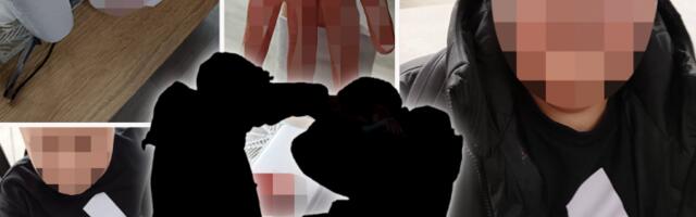 "TROJICA SU GA NAPALA, DETE JE U ŠOKU!" Oglasila se majka pretučenog dečaka u Vlasotincu za Republiku: OVO NIJE PRVI PUT! (UZNEMIRUJUĆE FOTOGRAFIJE)