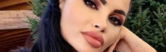 Predstavljala se kao misica iz Bosne i vrsni stručnjak, pa unakazila 11 osoba - uhapšena nadrilekarka i vlasnica salona lepote