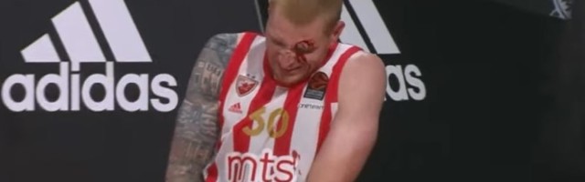 Neizvesnost oko Vajta - Arkada sanirana, čeka se snimak povrede leve ruke (VIDEO)
