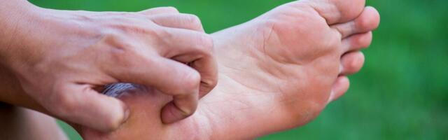 DOMAĆI TRIK MENJA SKUPI PEDIKIR! Ovaj sastojak košta sitno, a čini čuda za KURIJE OČI, ISPUCALE PETE I GLJIVICE