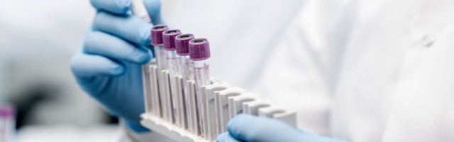 Najteže u Beogradu: Skoro 1.000 novoobelih