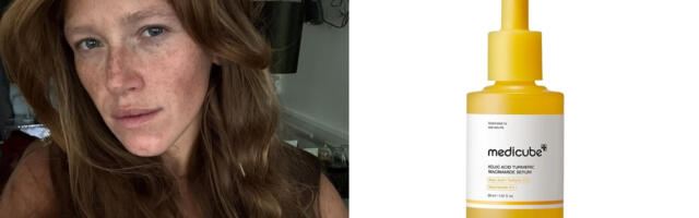 Serumi protiv staračkih pega: Koji sastojci zaista deluju i kako izabrati pravi proizvod?