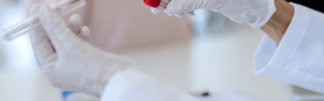 Obolelo 2.809 osoba, preminulo još 14 pacijenata