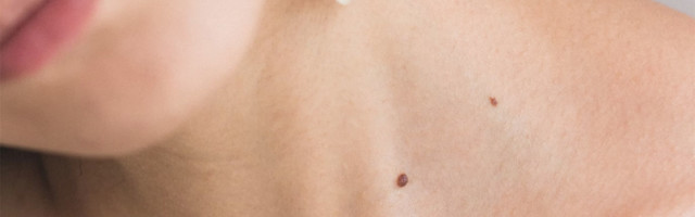 Kada ukloniti mladež?