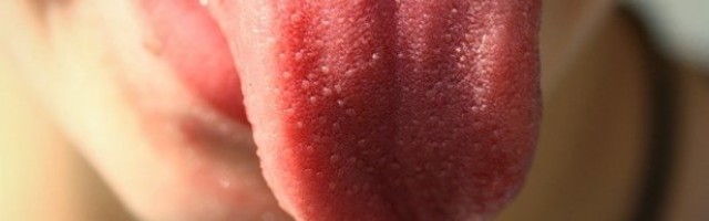 IZGLED JEZIKA OTKRIVA MNOGE BOLESTI! Ako je čist, svi unutrašnji organi su vam ZDRAVI, a ako JE OVAKAV...