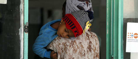 UN: U Jemenu do sada najveća pothranjenost djece