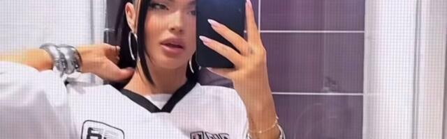 Plastičnog hirurga posetila prvi put sa 16 godina: Pevačica otkrila šta je menjala na sebi "Nisam preterala"