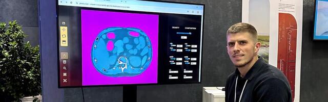 Upoznajte Stevana — naučnika iz Srbije koji je razvio AI softver za dijagnostiku raka!