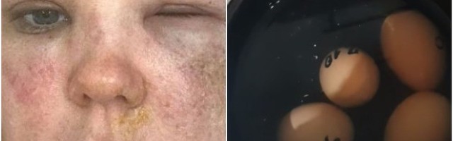 Isprobala trik za kuvanje jaja sa TV, pa u HITNOJ bila pet sati!