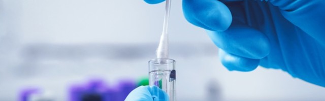 Slovenija: 1.656 novozaraženih, procenat pozitivnih vrlo visok