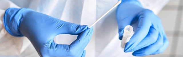 U Hrvatskoj 551 novi slučaj zaraze, umrlo 26 osoba