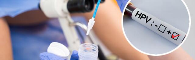 Svaka osma žena u Srbiji zaražena virusom koji izaziva rak, mnoge bez simptoma: Šokantni rezultati skrininga