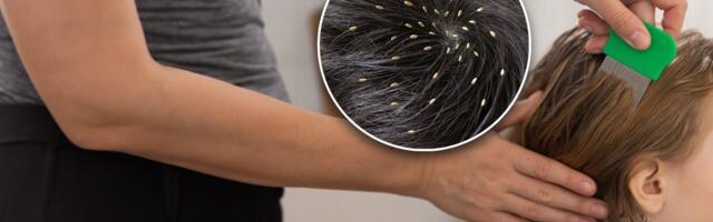 Vaške se pojavile u vrtićima! U ovom periodu se lako prenose, zbog njih planule posebne gumice u apotekama!