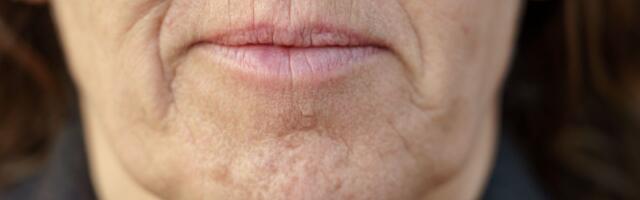 Ljudi su jedini primati sa bradom: Ni zbog privlačnosti, ni zbog žvakanja - brada je možda evolucioni "slučaj"