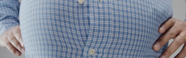 Гојазност директни узрок најмање 13 малигних болести