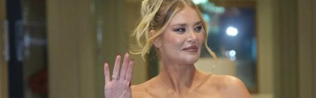 "Lice mi se izobličilo": Sofija Milošević zbog estetske intervencije bila u agoniji